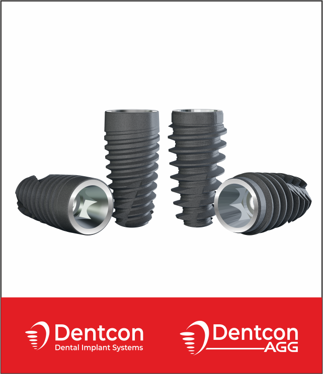 Dentcon Implant Systems